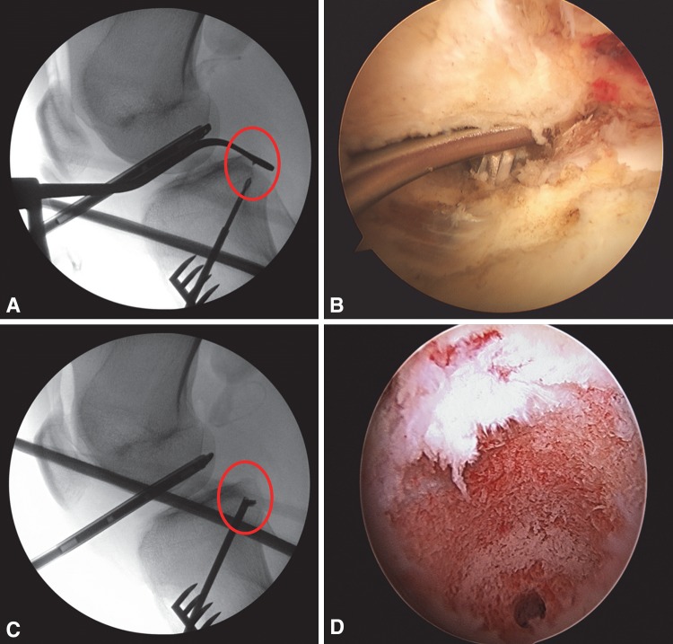 Fig. 4A–D