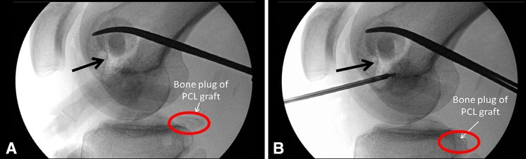 Fig. 7A–B