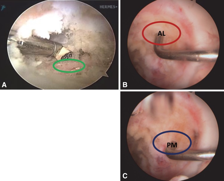 Fig. 3A–C