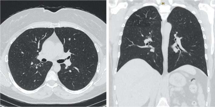 FIGURE 3