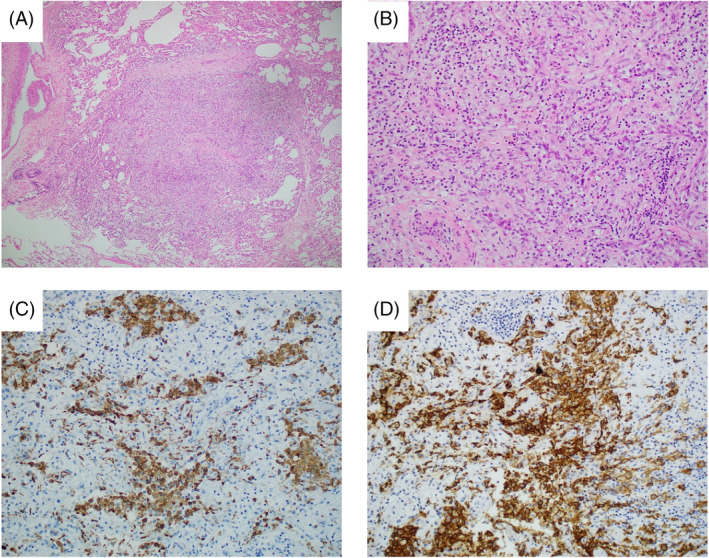 FIGURE 2