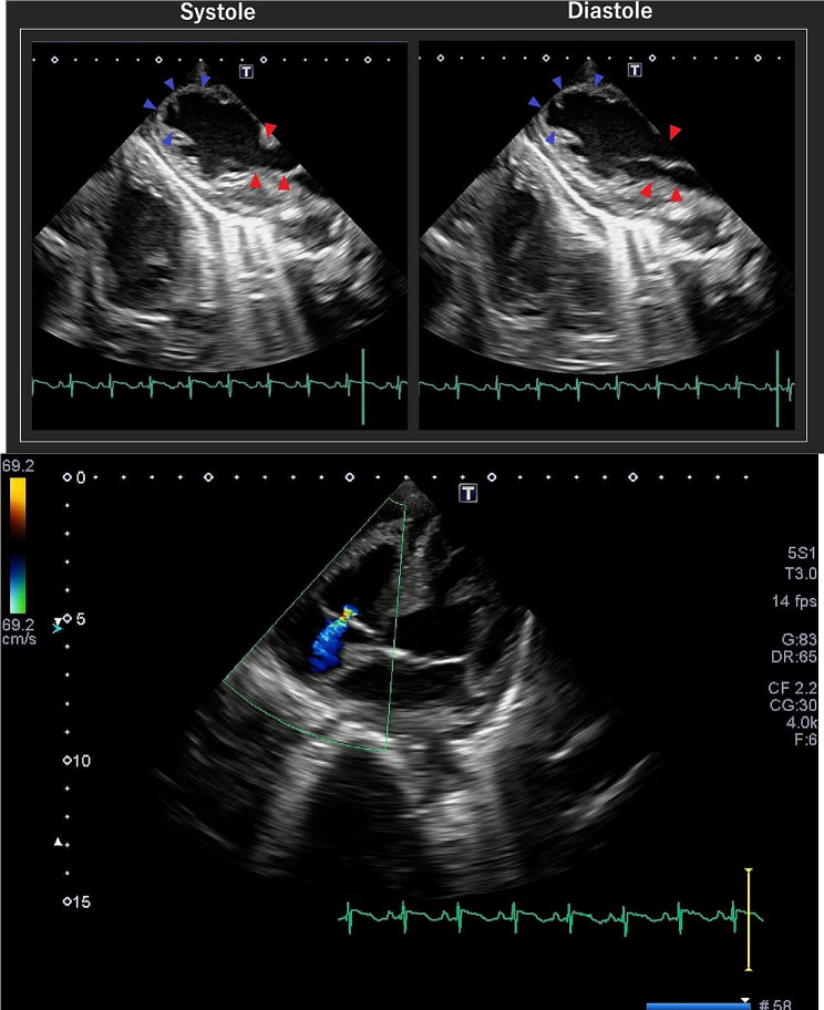 Fig. 2