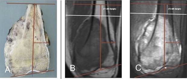 Fig. 1A-C