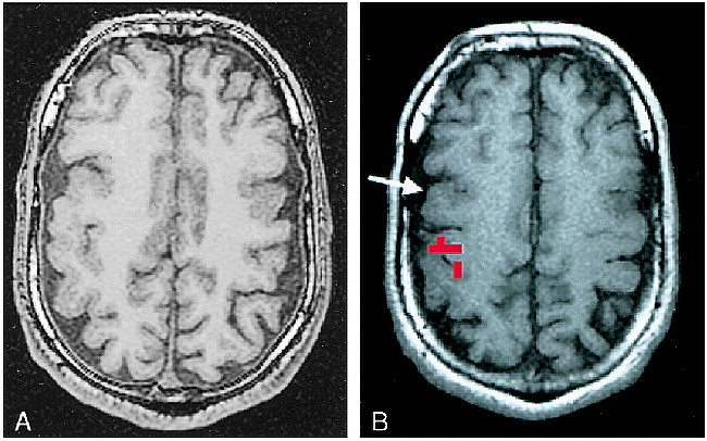 fig 2.