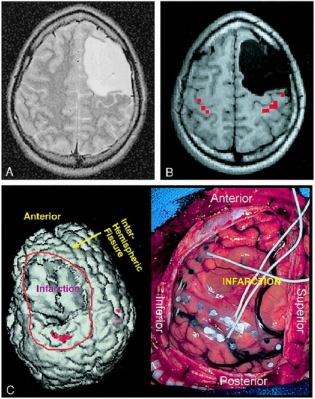 fig 4.