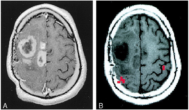 fig 5.