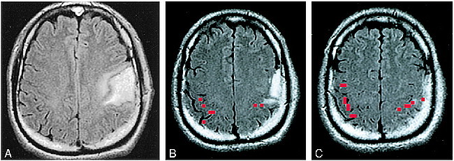 fig 1.