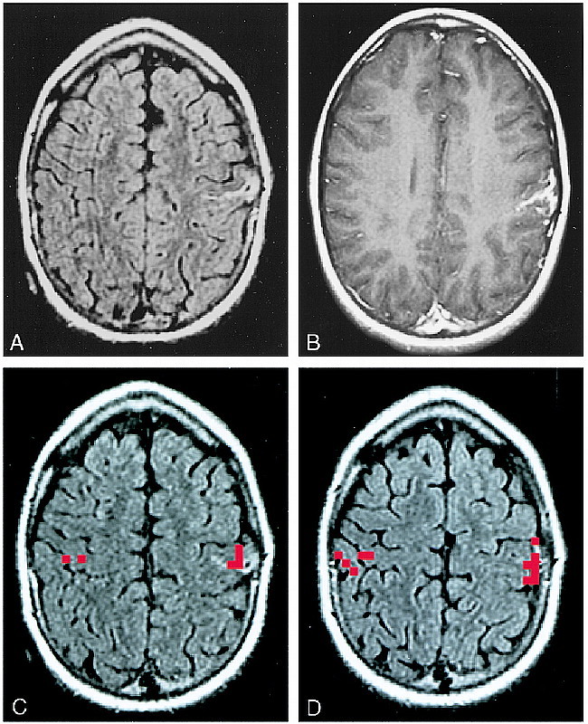 fig 3.