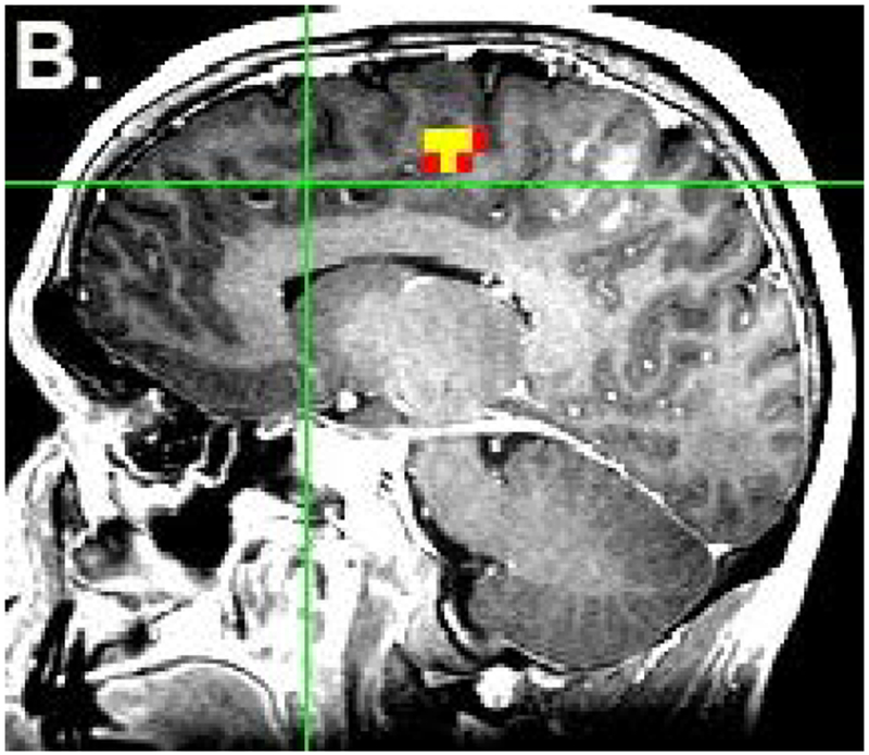 Figure 1: