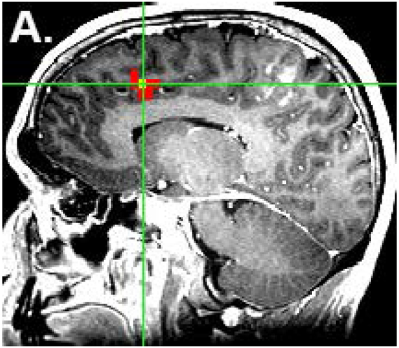 Figure 1: