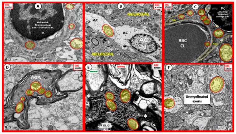 Figure 19