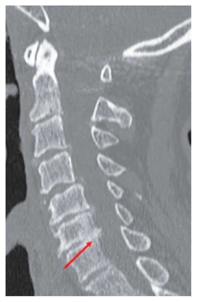 Fig. 5