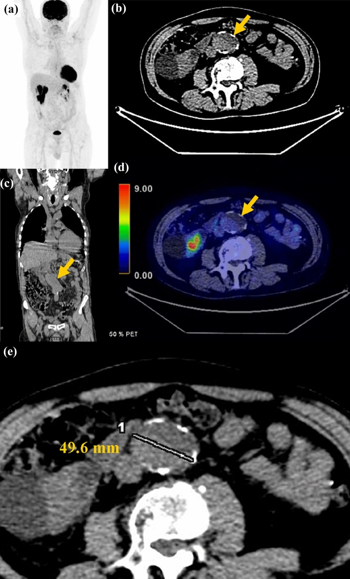 Fig. 2