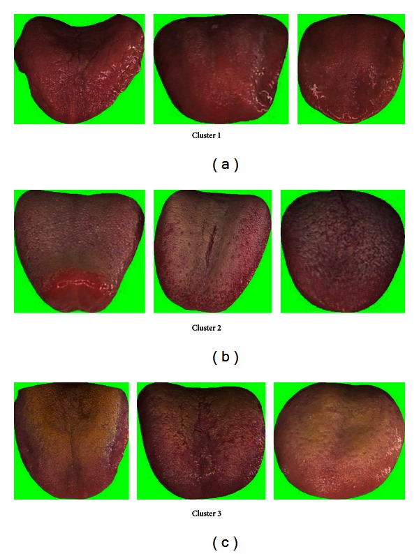 Figure 11