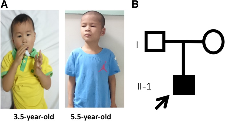 Fig. 1