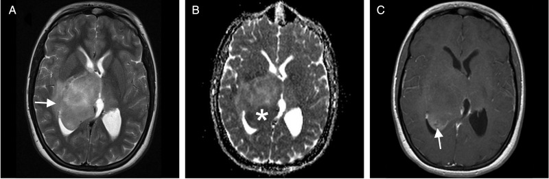 Fig. 3.