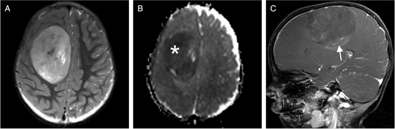 Fig. 1.