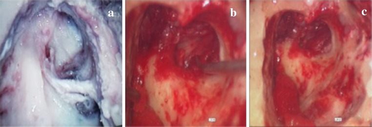 Fig. 2