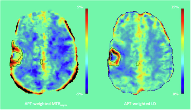 Fig. 4