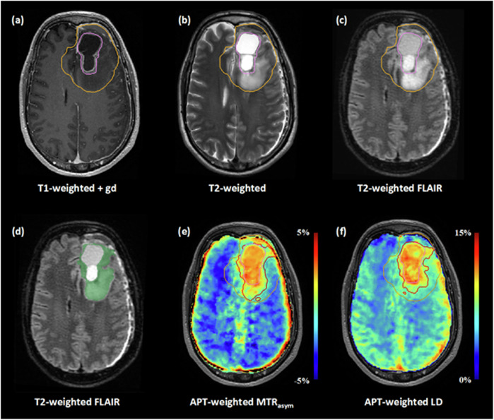 Fig. 3