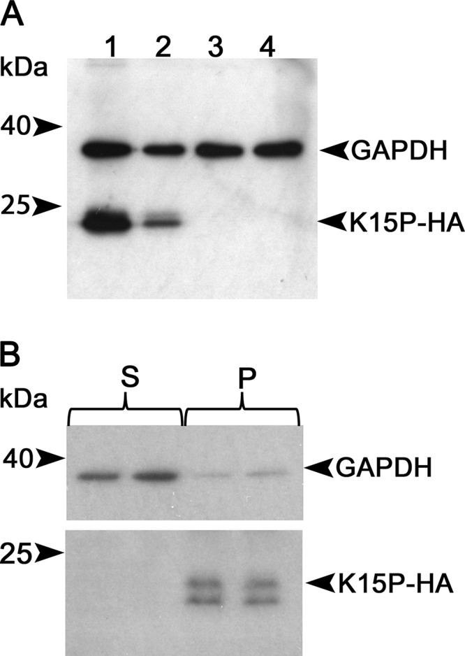 FIG 1