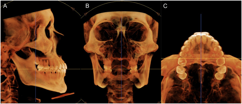 Fig 1