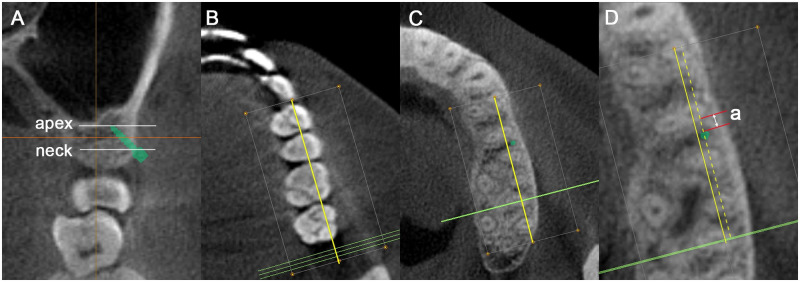 Fig 5