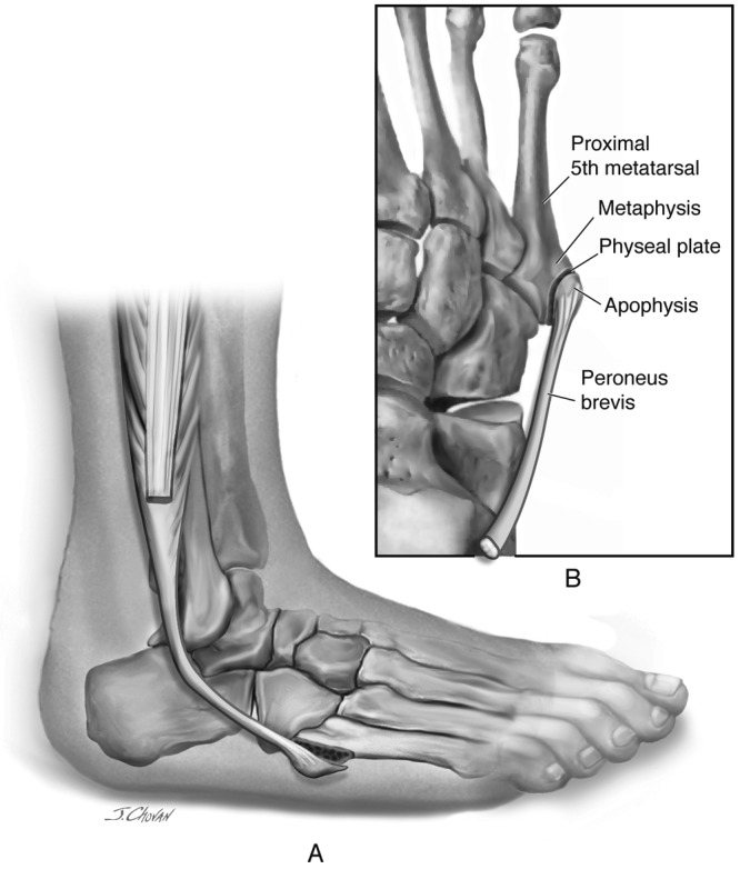 Figure 12.