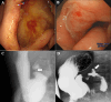 Fig. 2