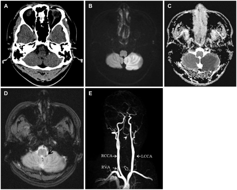 FIGURE 1