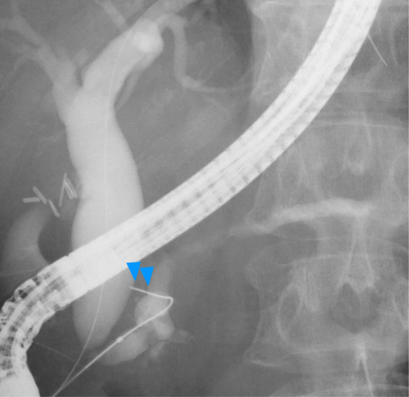 Fig. 3