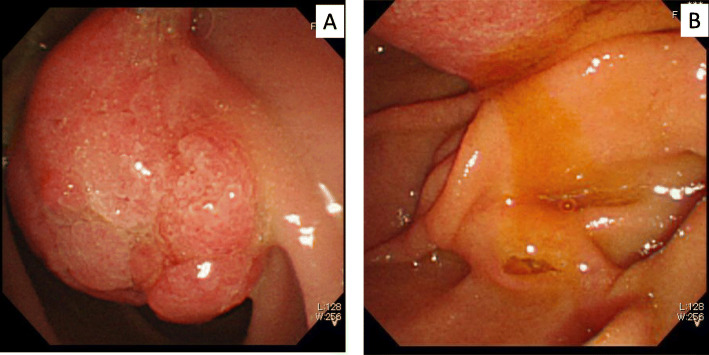Fig. 1