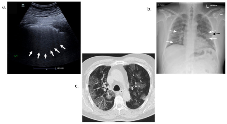 Figure 10