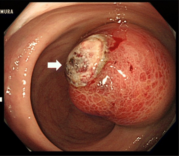 Fig. 2