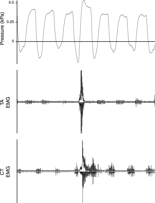 Fig. 13.