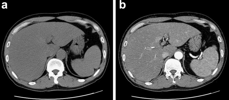 Fig. 1