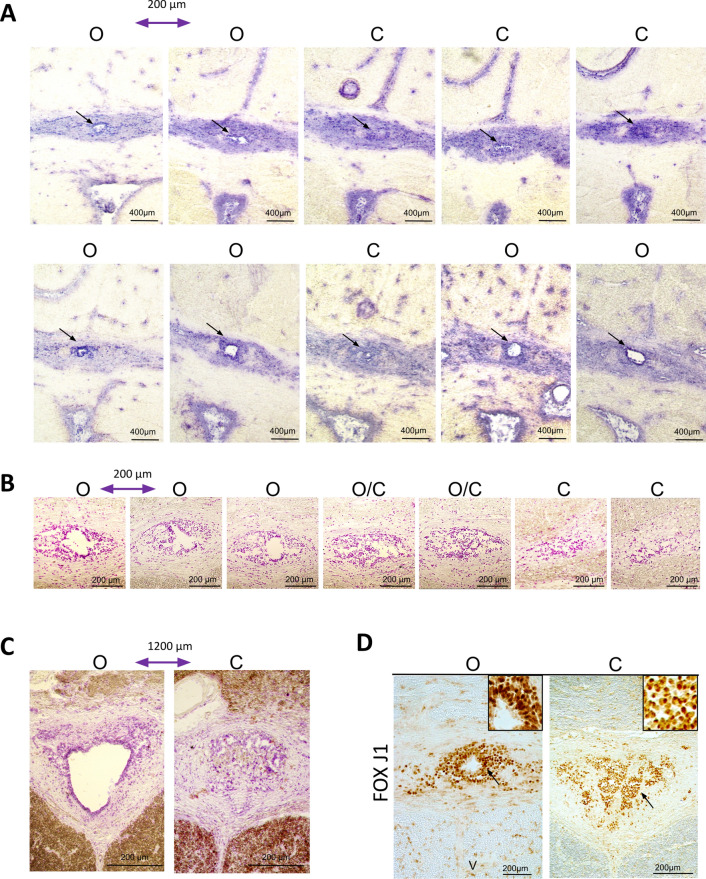 Fig. 11