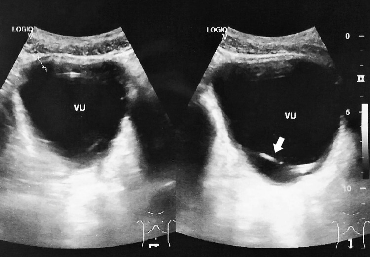 Fig 2 –