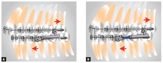 Figure 33