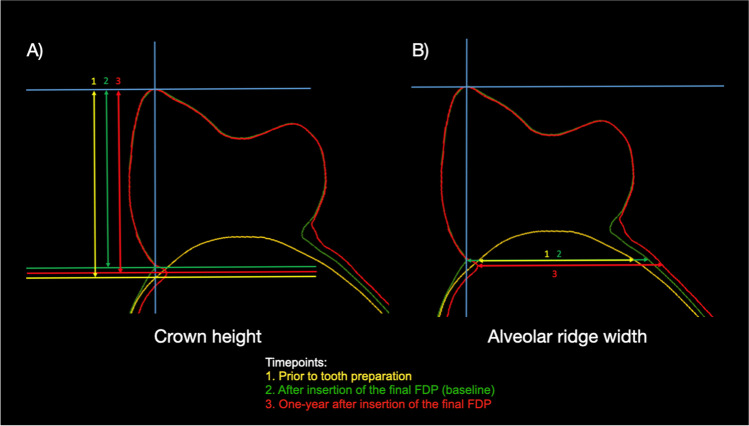 Fig. 3