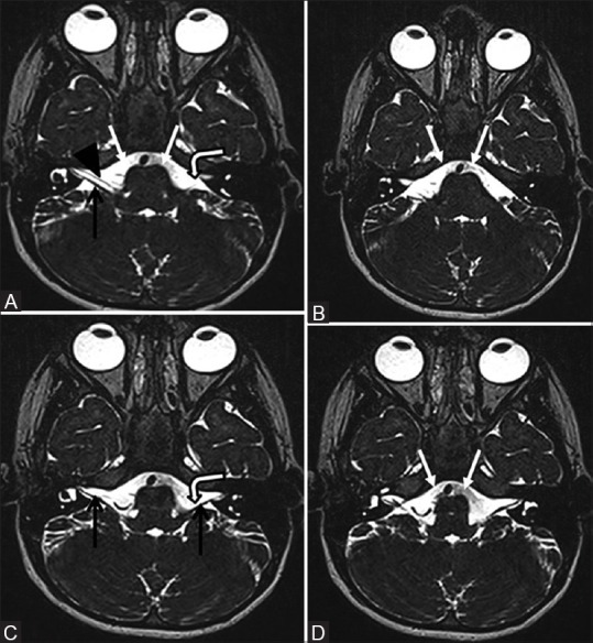 Figure 2 (A-D)