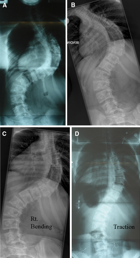 Fig. 1