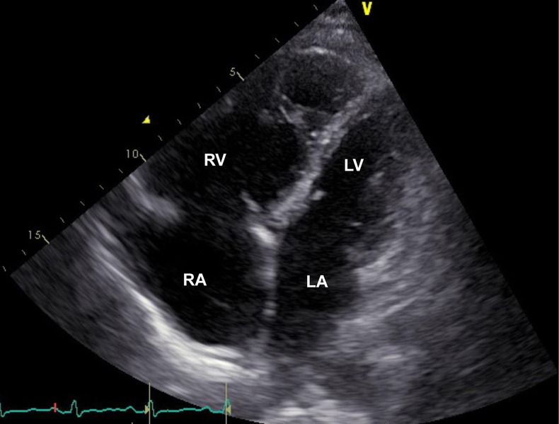 Figure 2