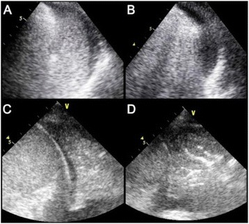 Fig. 16 (Abstract P094).