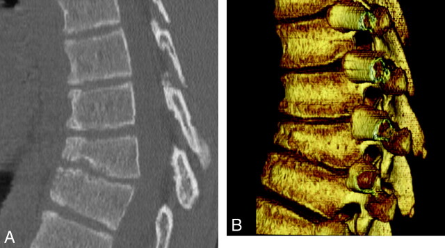 Fig 4.