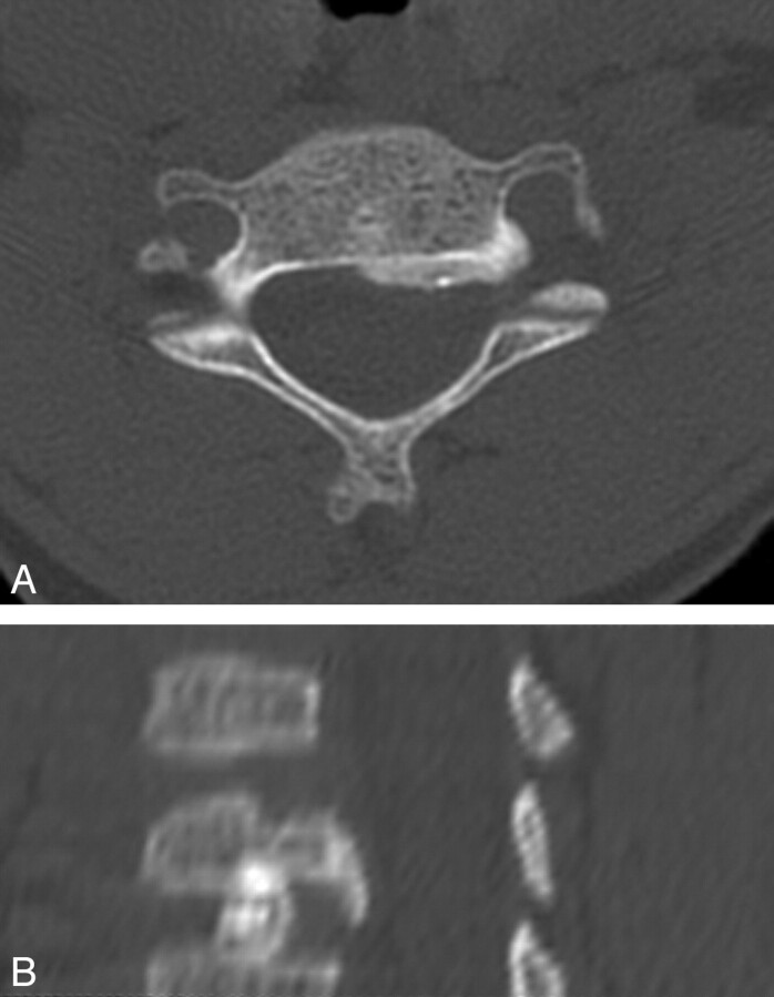 Fig 6.