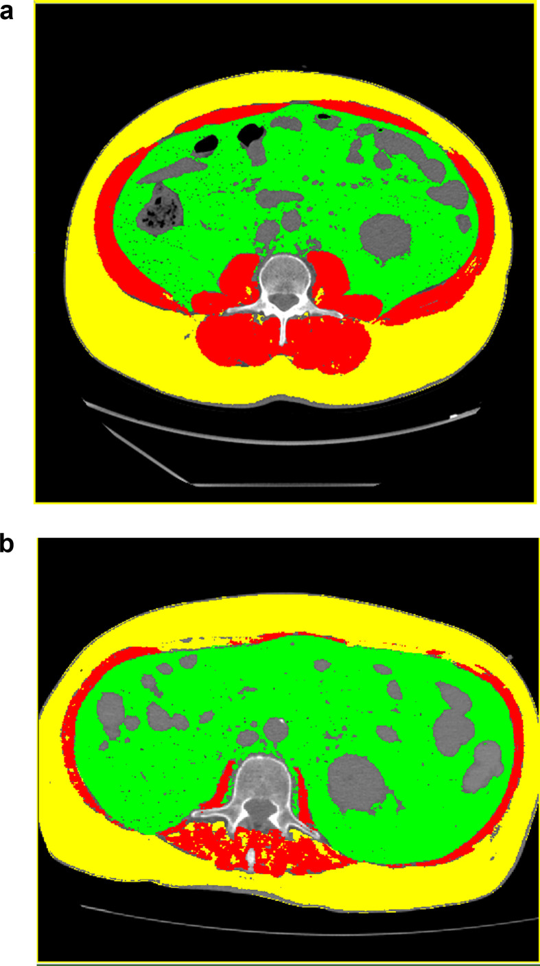 Fig. 1