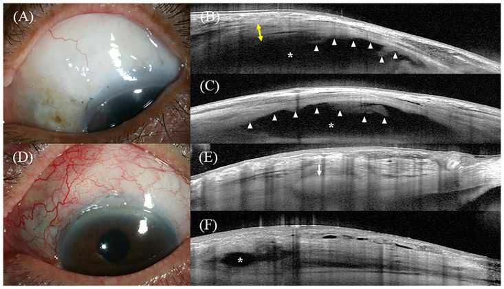 Fig 5