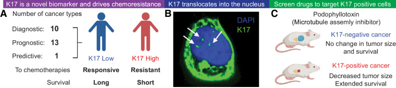 Figure 1. Significant findings on K17 suggest it is an ideal therapeutic target. A, Overall, K17 is a predictive, prognostic, and diagnostic biomarker in several different cancers. K17 was previously found to predict therapeutic response of tumors, such that low K17 expression in tumors is correlated with longer patient survival and high K17 expression in tumors is correlated with shorter survival in patients. K17 was shown to promote chemoresistance to first-line chemotherapeutic regimens that do not target K17. B, K17 translocates into the nuclei of cancer cells to promote tumorigenic functions. Confocal imaging shows K17 (green) and nucleus staining with DAPI (blue). C, An unbiased high-throughput drug screen revealed several potential molecules that can target K17-expressing PDAC cells, including podophyllotoxin, a microtubule assembly inhibitor.