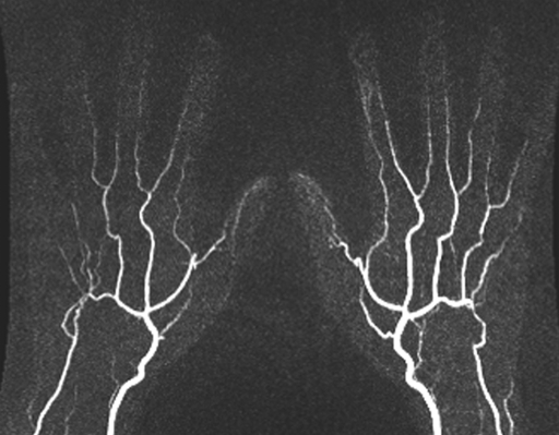 Figure 3b: